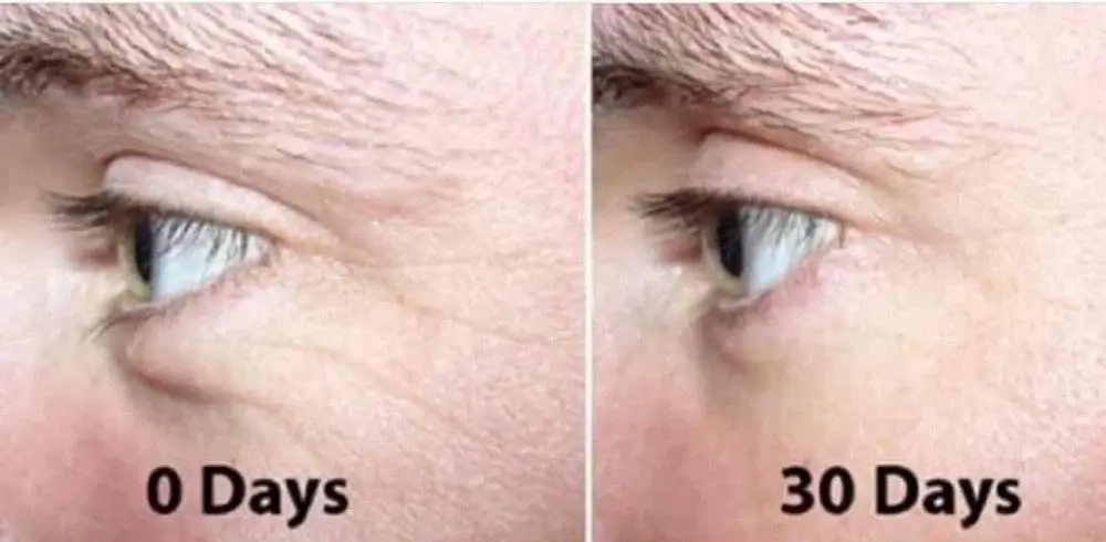 The Ordinary Argireline